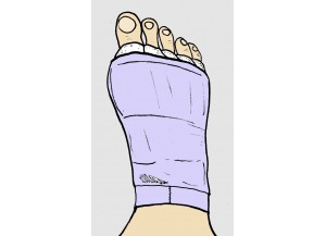 Post cirugía de pies